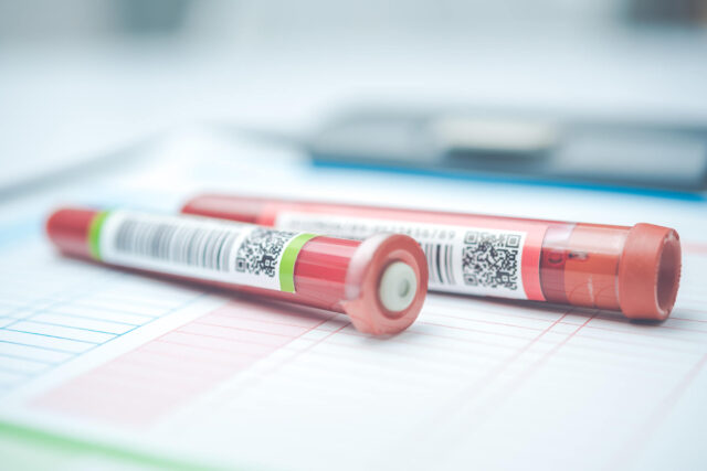 採血管