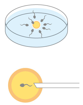 体外受精の絵